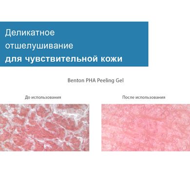 Пілінг - гель з лактобіоновою кислотою Benton PHA Peeling Gel, 70мл Купити в офіційному магазині Україні