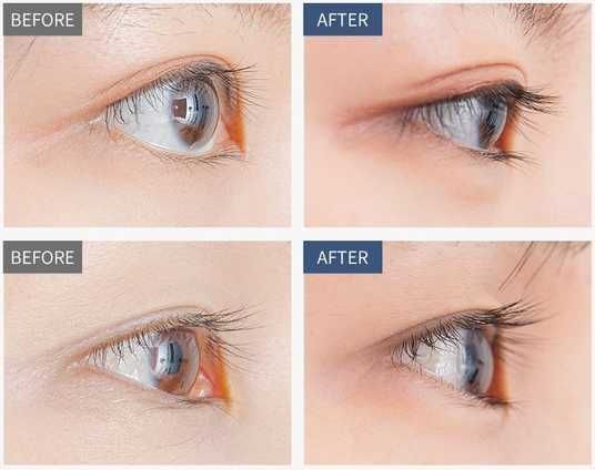 Benton Honest Eyelash Serum ➤Офіційний сайт Benton в Україні